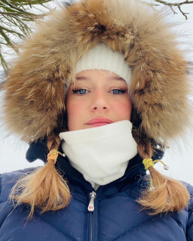 Your Teen Winter Skin Survival Guide